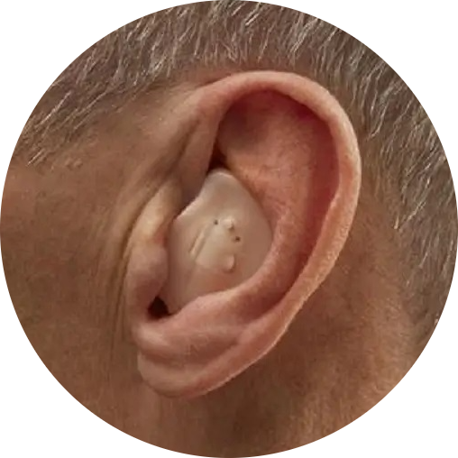 In-the-Ear (ITE) Hearing Aids-modified